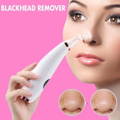 Blackhead remover